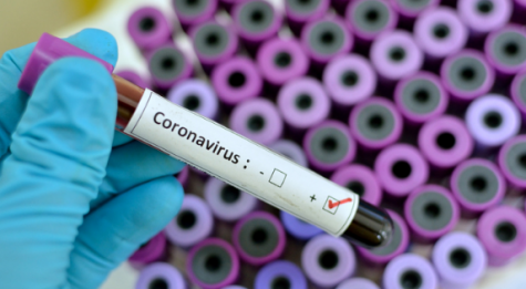 The outbreak of the Coronavirus is causing panic in China and other countries. 